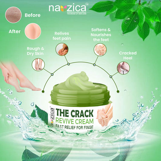 Nauzica Cracked Skin Remove Heel, Finger Healing Balm-50gm